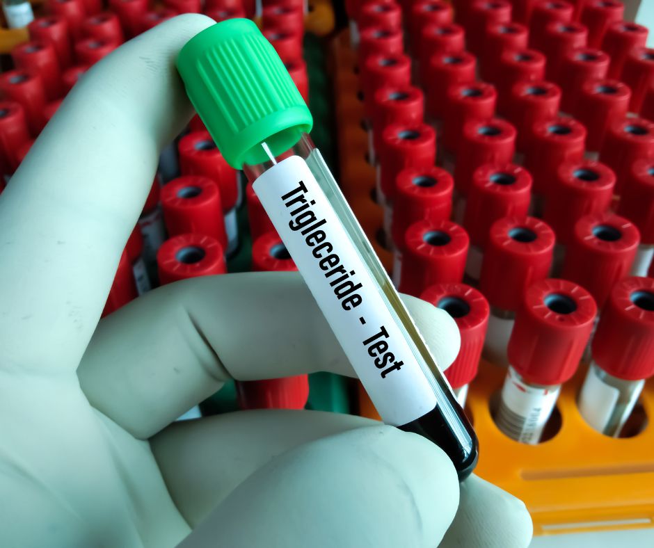 probówka laboratoryjna z materiałem do testów na poziom trójglicerydów we krwi